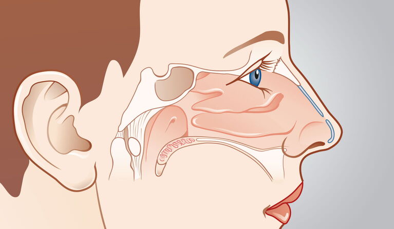 Nasal turbinate bone & nasal spongy tissue teaser picture
