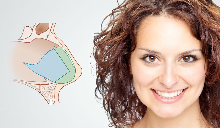 Nasal septum & nose correction teaser picture