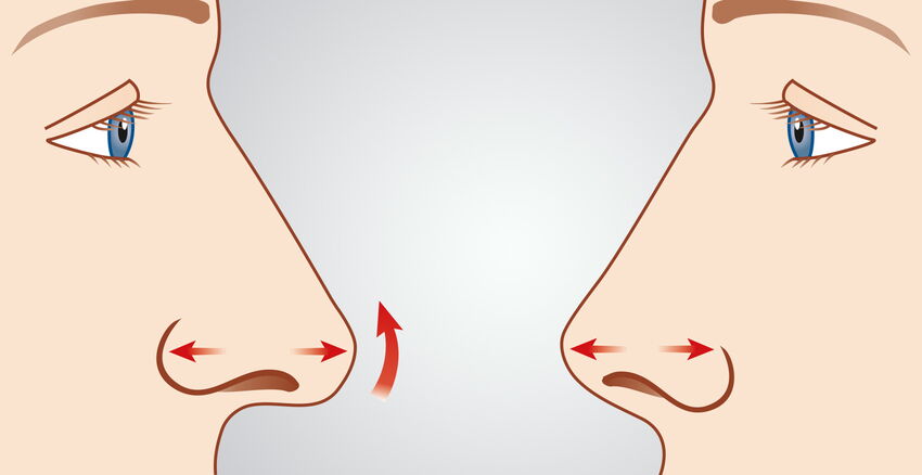 Tip of nose correction header picture