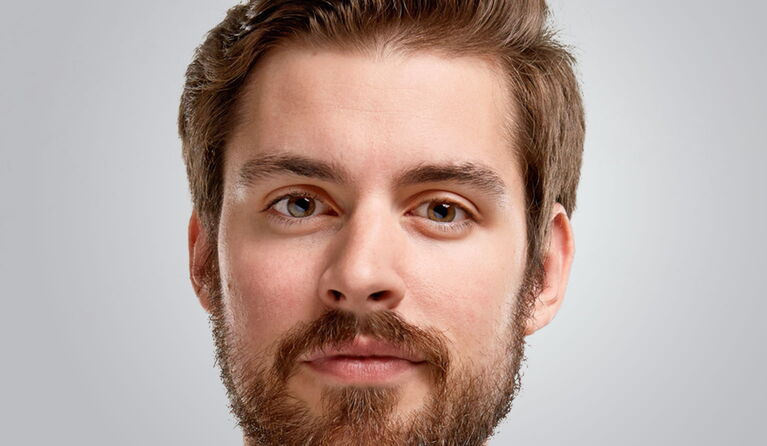 Crooked nose teaser picture