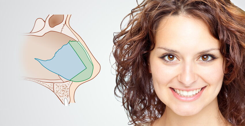 Correction of the nasal septum & nose correction header picture