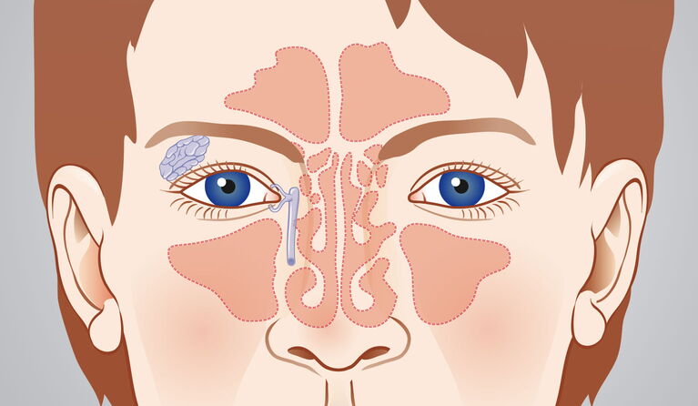 Sinus cavities teaser pictures