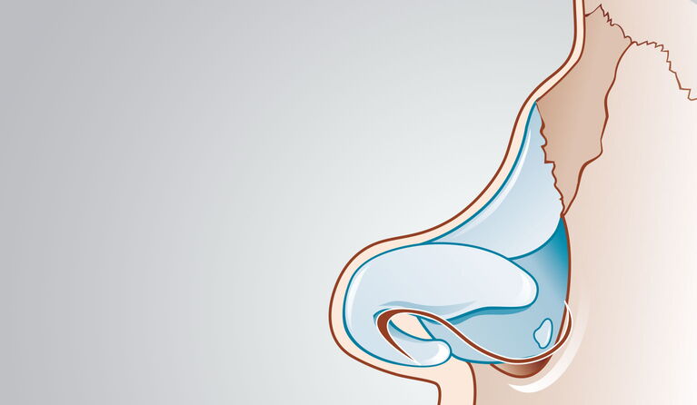 Saddle nose teaser picture