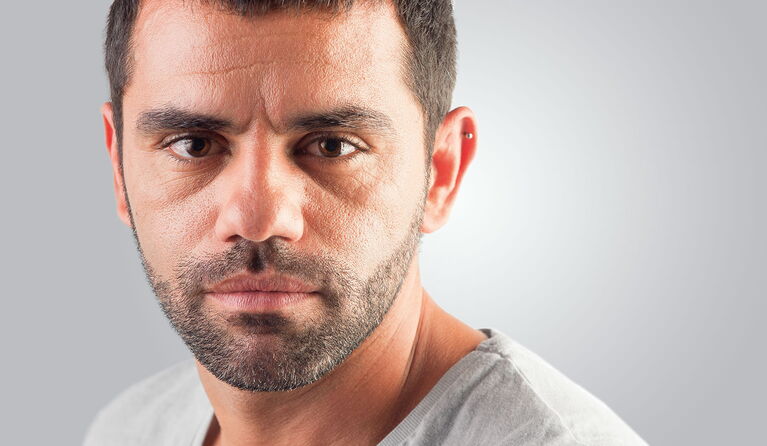 Boxer nose & wide nose teaser picture