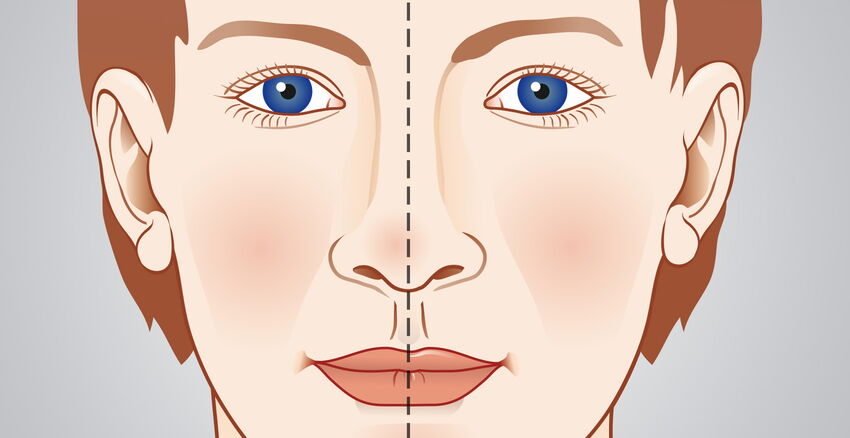 Nose straightening header picture