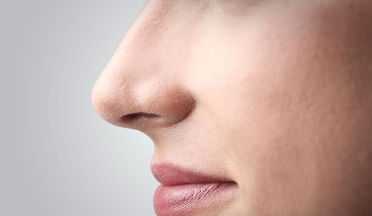 Functional and aesthetic nose corrections teaser picture