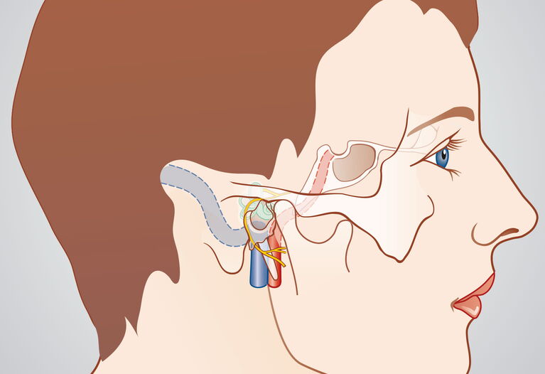Schädelbasis-Chirurgie. Unsere intensive und jahrelange Ausbildung für die Chirurgie der seitlichen Schädelbasis kommt Patienten aus nah und fern zugute.