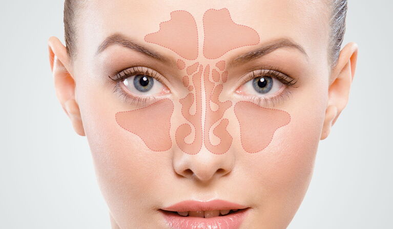 Operation on the sinus cavities & nose correction teaser pictures