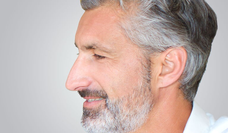 Long nose teaser pictures