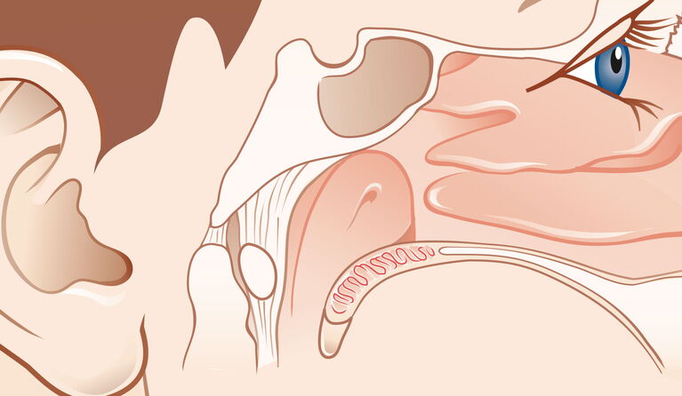 Anterior base of the skull teaser picture