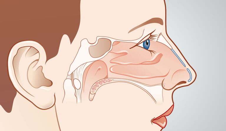 Special nasal surgery teaser pictures