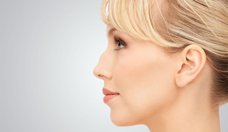 Hump nose teaser picture